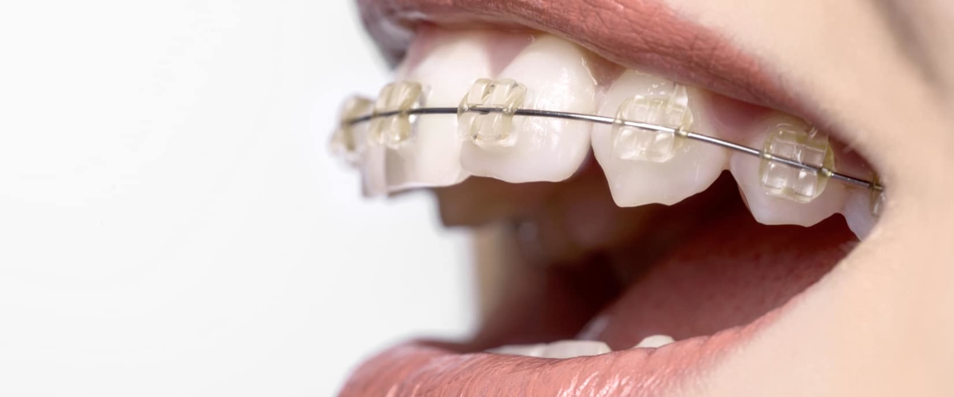 What does orthodontic treatment mean?