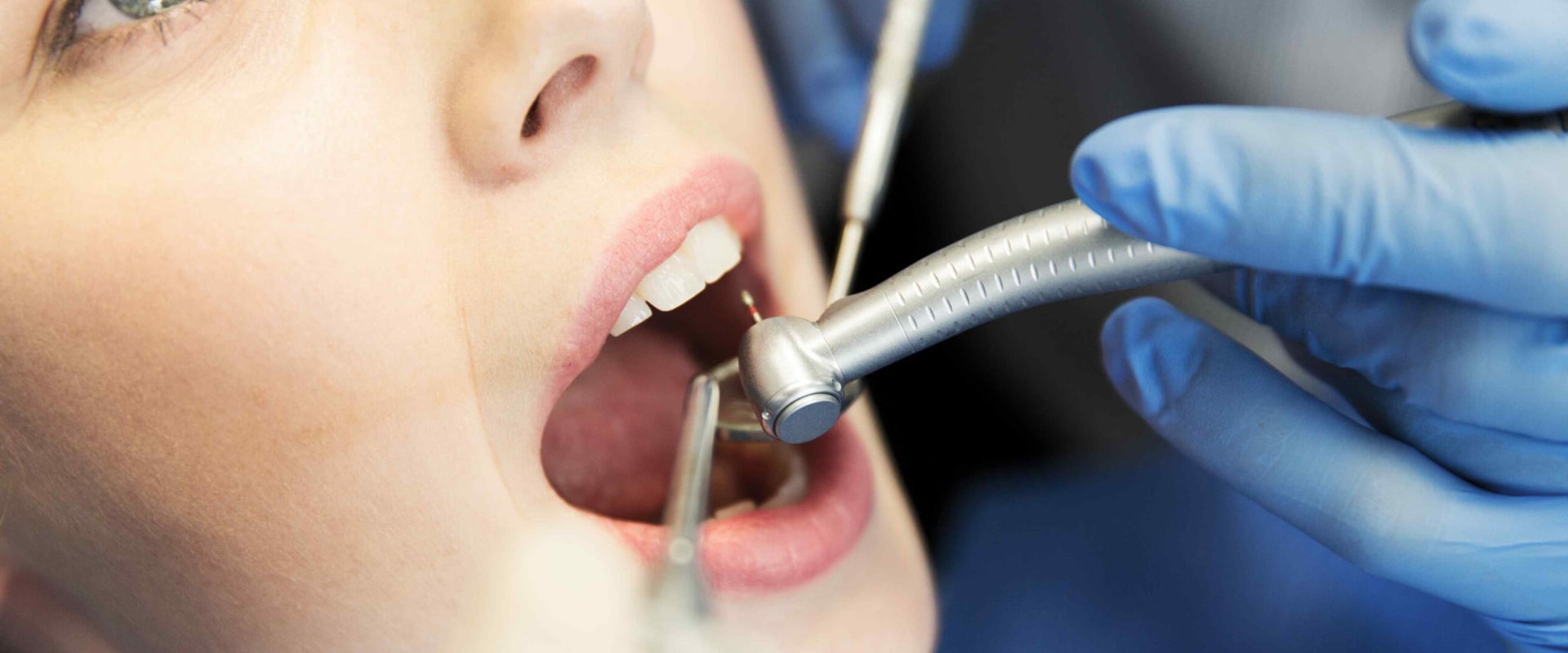 What is the most popular dental procedure?