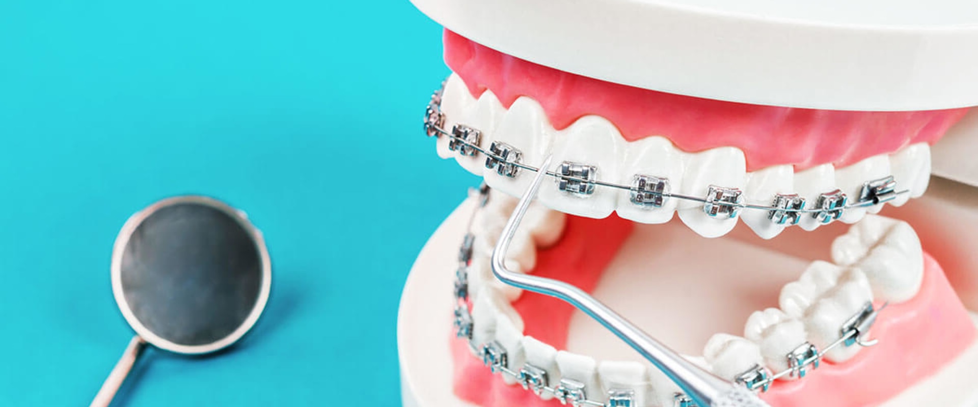 Are dental braces considered cosmetic?