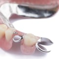 What is the difference between cosmetic dentures and regular dentures?