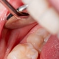 Are braces more than cosmetic?