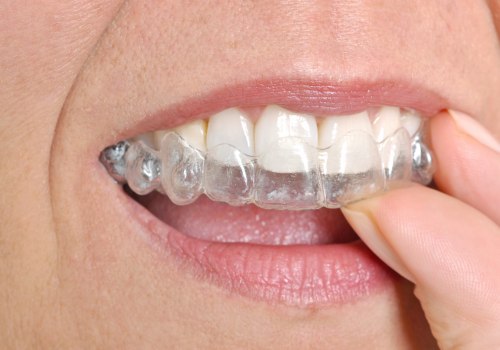 Invisalign In Spring, TX: Your Guide To Straightening Your Teeth With Cosmetic Dentistry