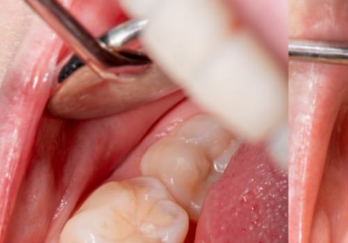 Are braces more than cosmetic?