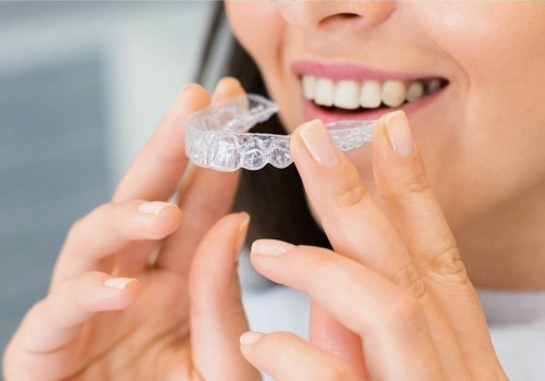 Transform Your Smile With Invisalign In San Antonio: The Ultimate Guide To Cosmetic Dentistry