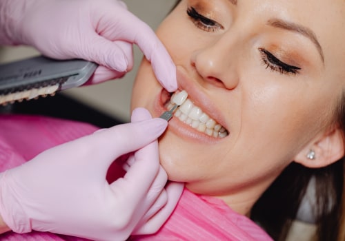 Transform Your Smile With Porcelain Veneers: Cosmetic Dentistry In Conroe, Texas